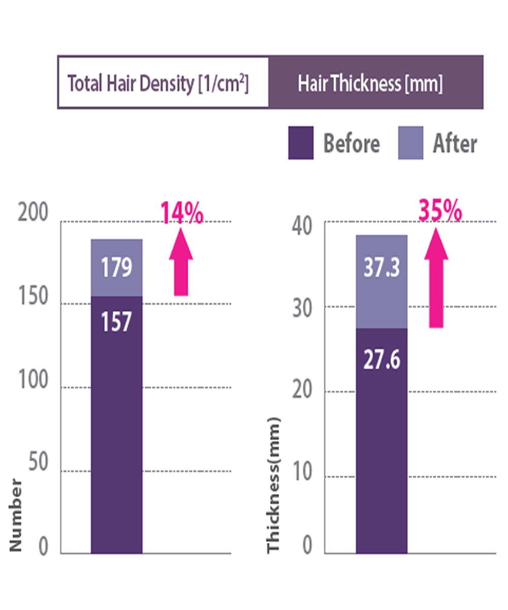Hair Density Study <span style=