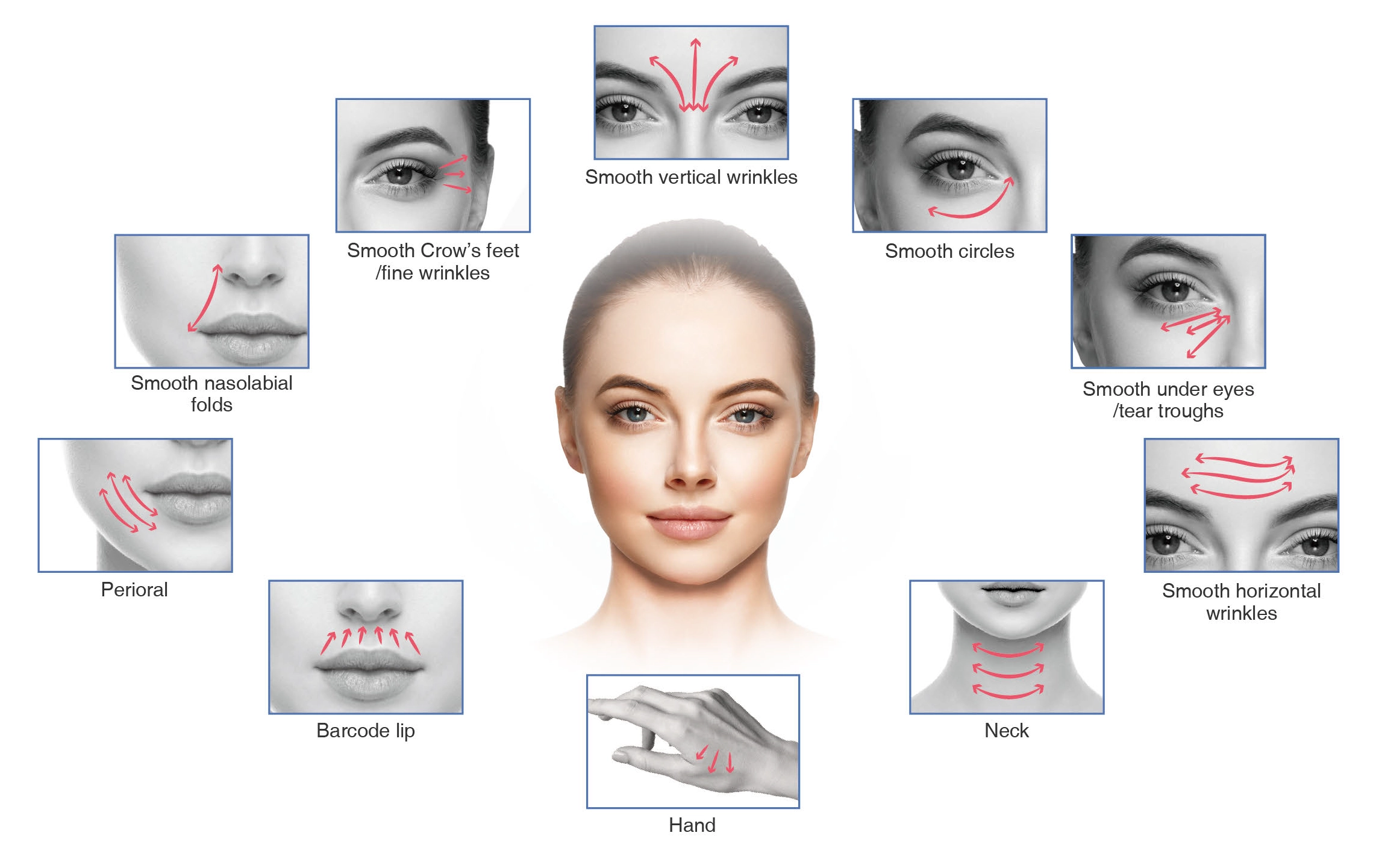 Treatment Areas