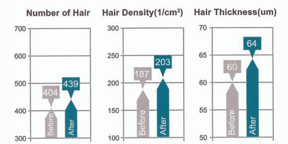 Clinical Result 2