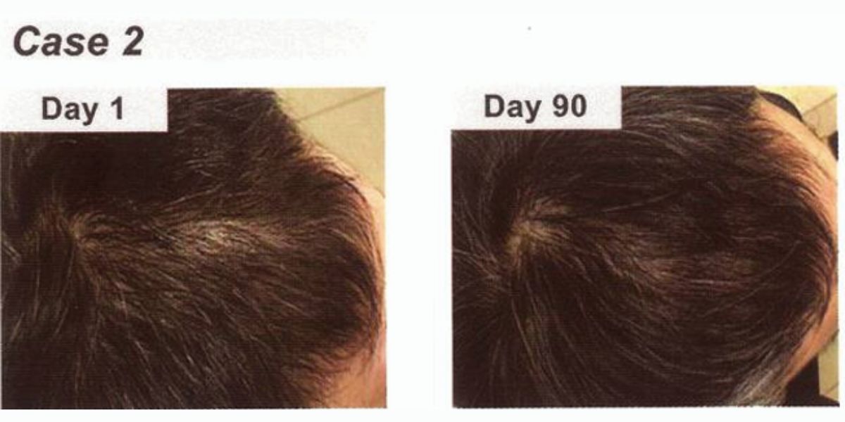Clinical Result 3